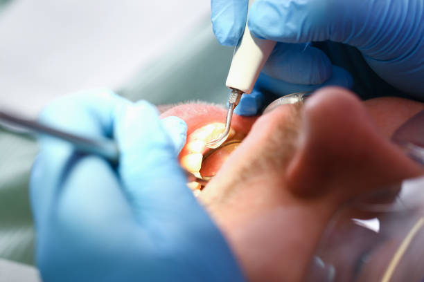 Best Weekend Emergency Dentist in Goulding, FL