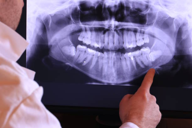 Best After-Hours Emergency Dentist in Goulding, FL
